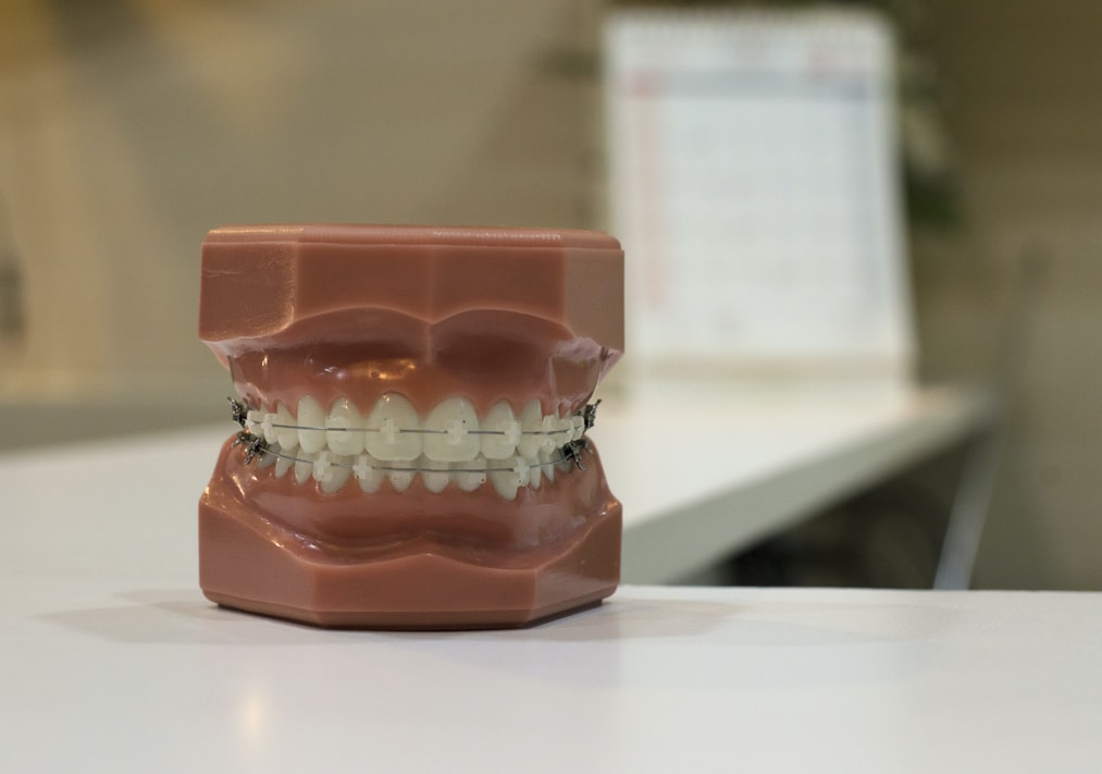Factors to Consider When Choosing a Dental Clinic